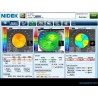 NIDEK OPD Scan III VS Corneal Topographer Refractive Power Corneal Analyzer